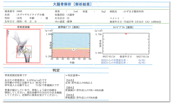 プロファイルスキャン解析