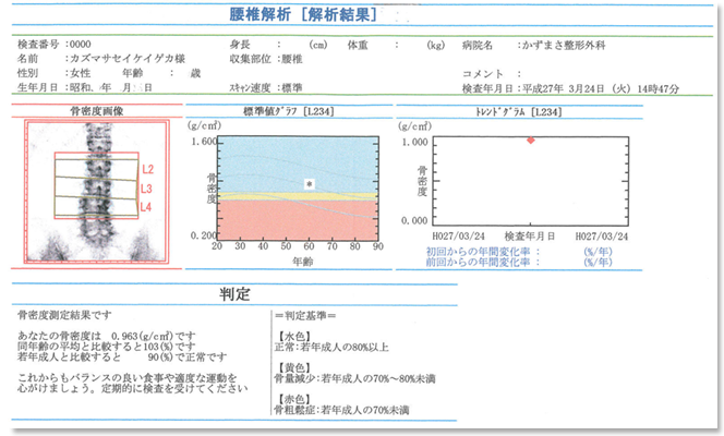 プロファイルスキャン解析